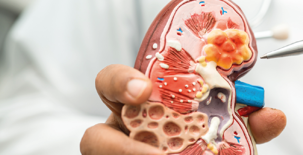 Nefrología infantil